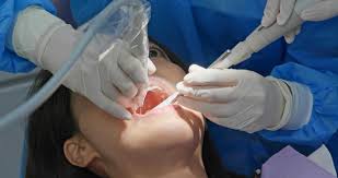 Root Root Canal Treatment