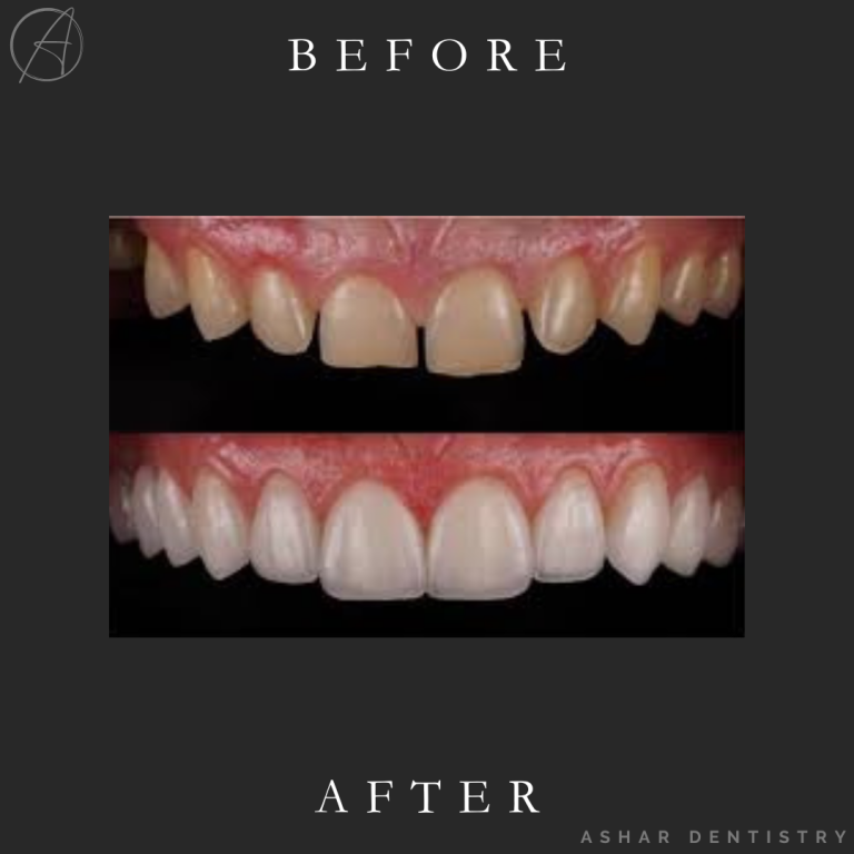 Black and White Lash Tech Before and After Instagram Post (4)